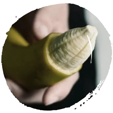 Circuncisión Circuncisión